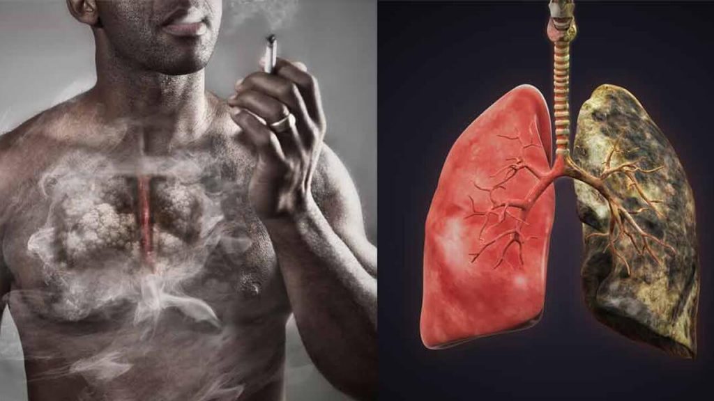 Fumar y cáncer de pulmón